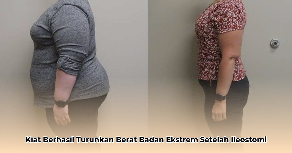 extreme weight loss after ileostomy